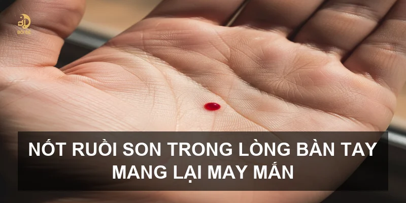 Giải mã ý nghĩa nốt ruồi trong lòng bàn tay: Vận mệnh sang hay hèn?