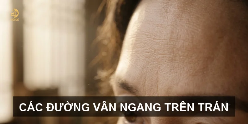 Các đường vân ngang trên trán